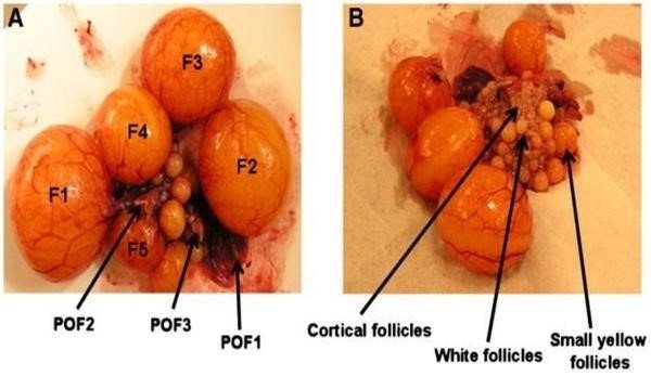 Follicle hierarchy POF1, POF2 & POF3